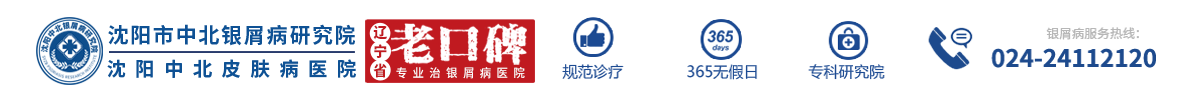 「遼寧省沈陽市中北醫院」-沈陽好的銀屑病醫院-沈陽銀屑病要去哪治療-沈陽哪家看銀屑病看的好