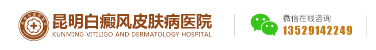 昆明白癜風醫院有幾家-昆明治療白癜風哪家好|地址在哪里-云南昆明白癜風醫院-昆明白癜風專科醫院